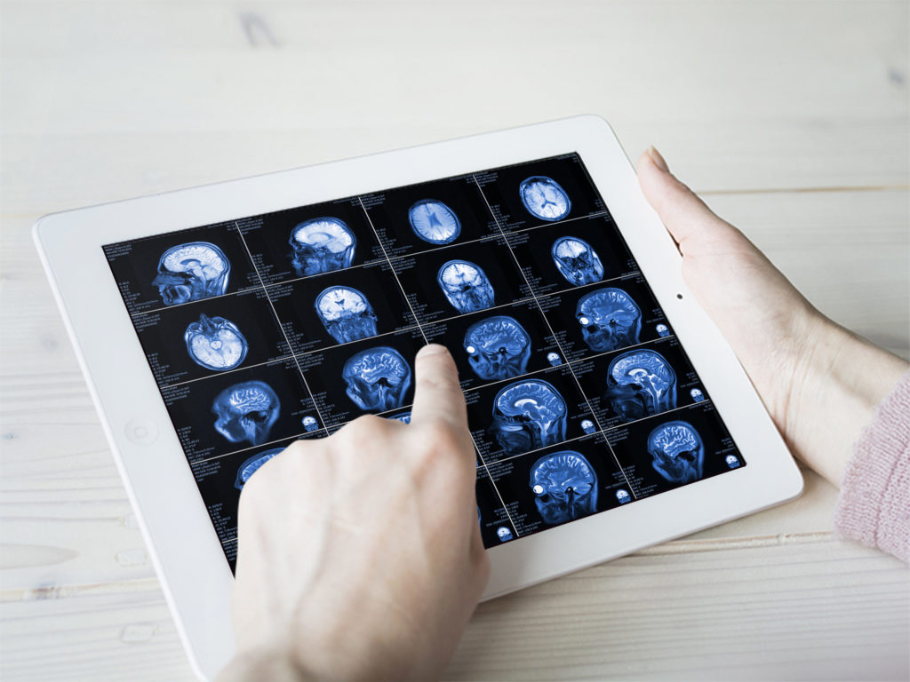 Hands hold MRI scan of head, neck and brain of patient, holding in hands